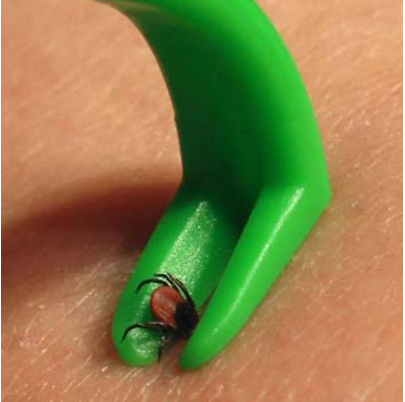 Háčik na vyberanie kliešťov O'TOM 2 ks/bal.